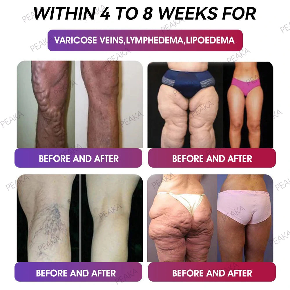 Official Store | PEAKA® GLP‑1 Slimming Vitality Boost Oral Strips 🥇 NAD+ Natural Formula with Moringa & Herbal Extracts | Visible results in 7 days ✅ Supports weight loss, heart health, blood sugar, sleep, joints & more.