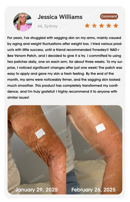 【Official Authorized Store】Tnnedey® NAD+ Bee Venom Patch ⚡– Best Choice for Firming Skin, Supporting Healthy Weight, and Balanced Blood Sugar（Last Day Discount：80%）