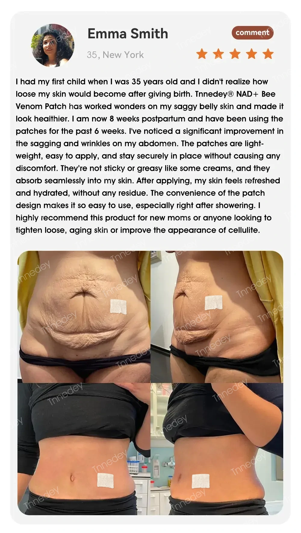 【Official Authorized Store】Tnnedey® NAD+ Bee Venom Patch ⚡– Best Choice for Firming Skin, Supporting Healthy Weight, and Balanced Blood Sugar（Last Day Discount：80%）