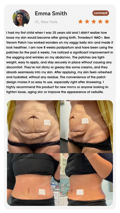 【Official Authorized Store】Tnnedey® NAD+ Bee Venom Patch ⚡– Best Choice for Firming Skin, Supporting Healthy Weight, and Balanced Blood Sugar（Last Day Discount：80%）